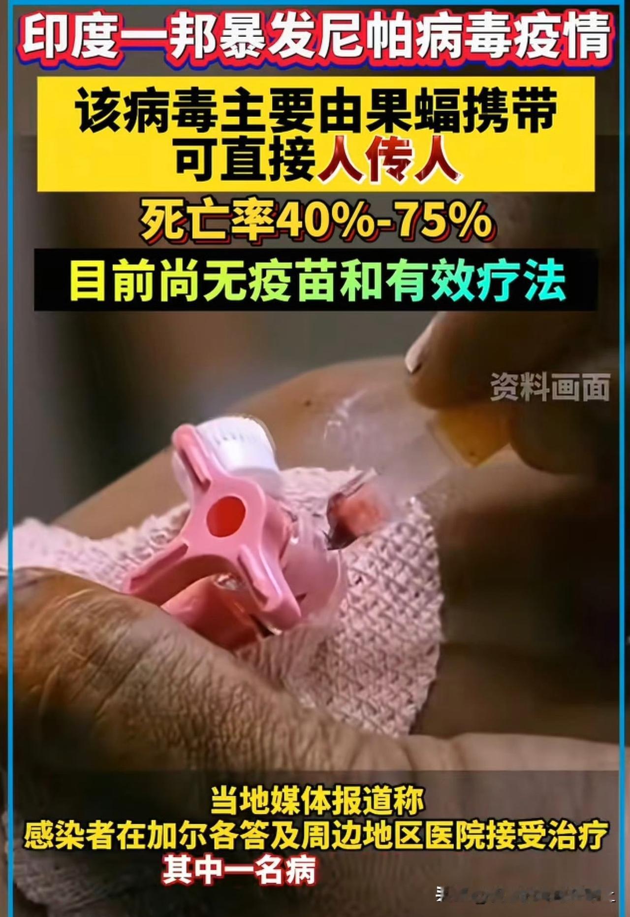 我感觉国内就是谈疫色变
虽然看了半天 现在新闻也真的是 都没讲清病毒是哪种病毒 