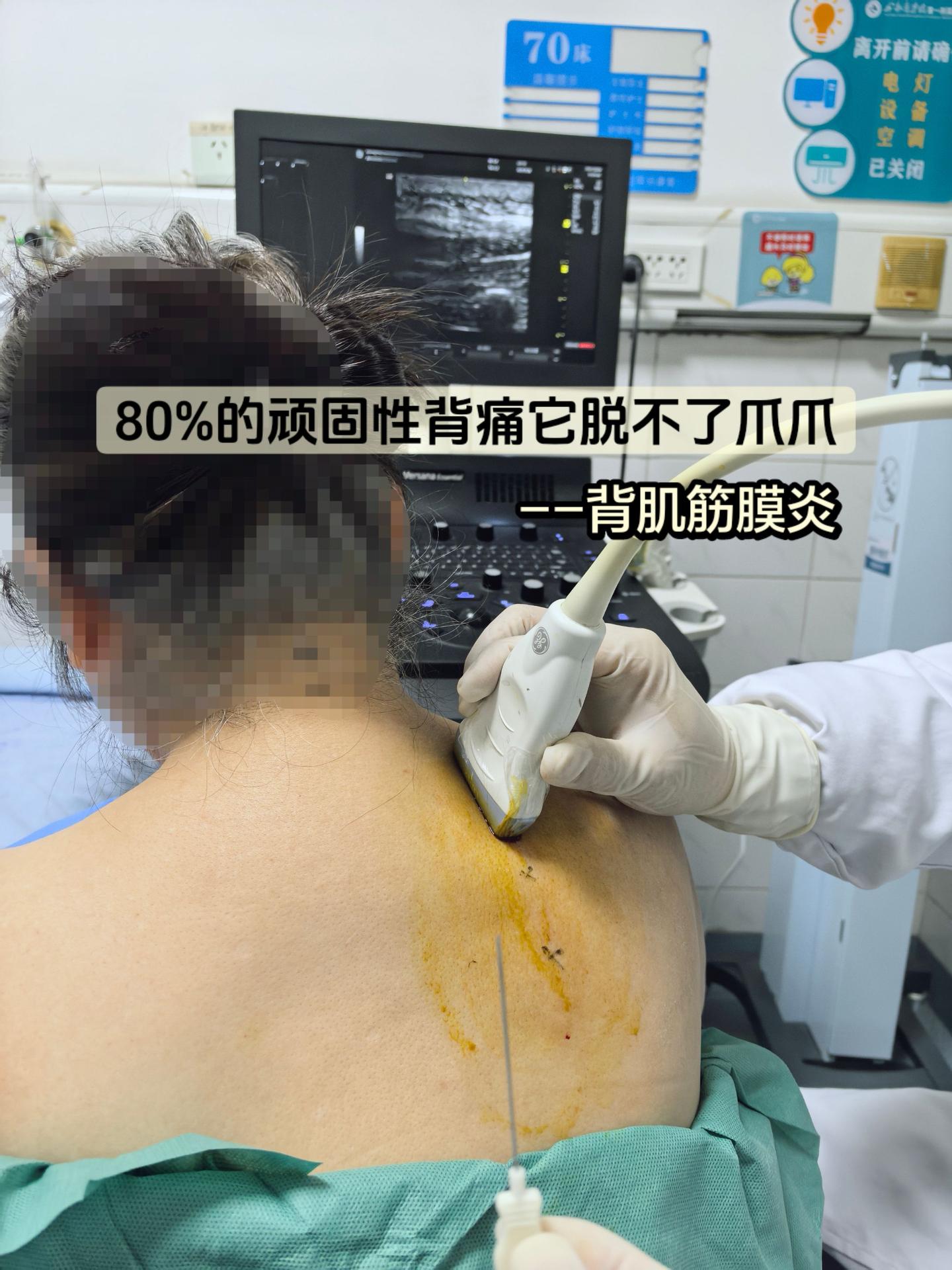 晓看天色暮看云，行也思“筋”坐也思“筋”