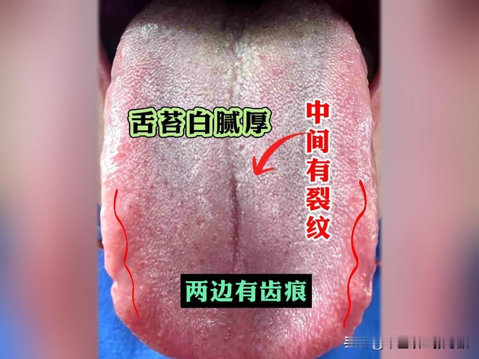 中年危机压力大，简直快把大哥压垮了[吃瓜群众][吃瓜群众][吃瓜群众][吃瓜群众