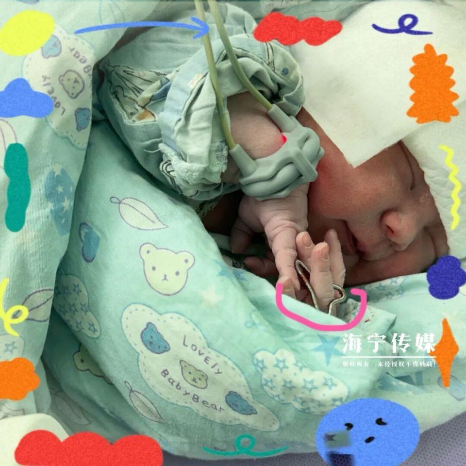 《海宁“天选女宝”降生！医生直呼罕见：这概率比中彩票还低》

35岁河南籍妈妈在