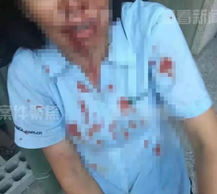 上海一中院终审改判，

泼脱漆剂的舅妈不赔不罚，

三秒内发生的事到底算啥。
