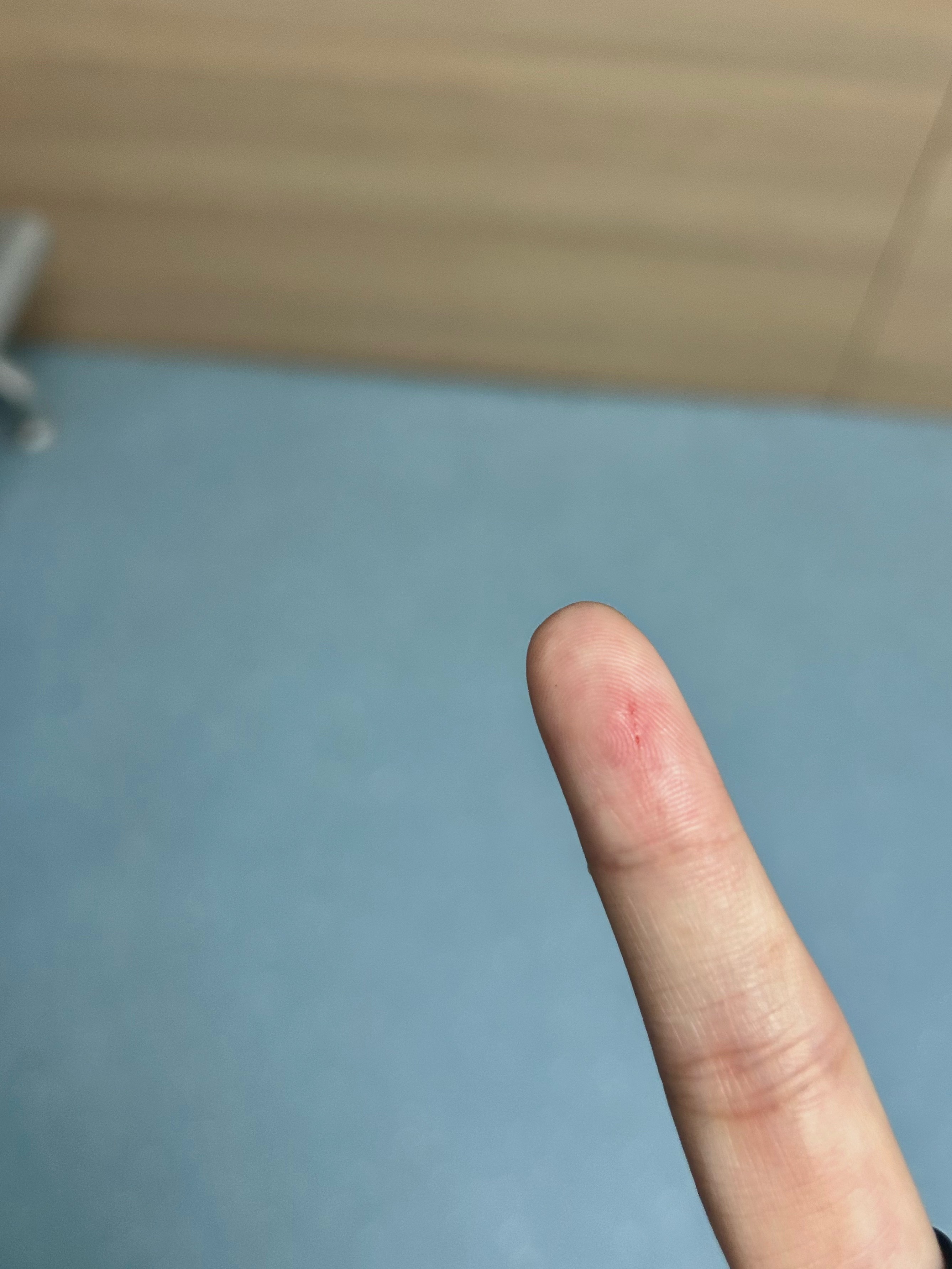 好命苦我又来打狂犬疫苗了