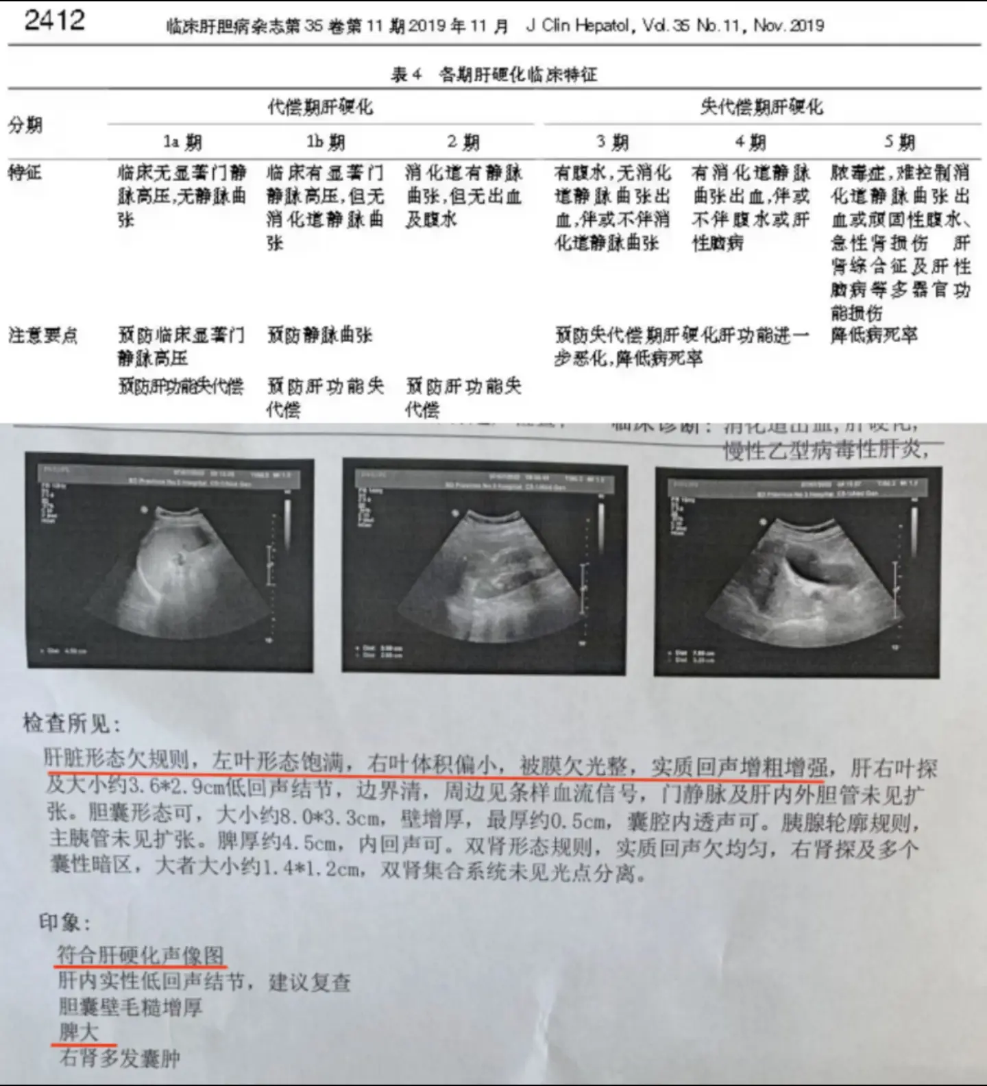 肝硬化如何判断严重程度？肝硬化有轻有重，临床上分为代偿期（早期）和失代...