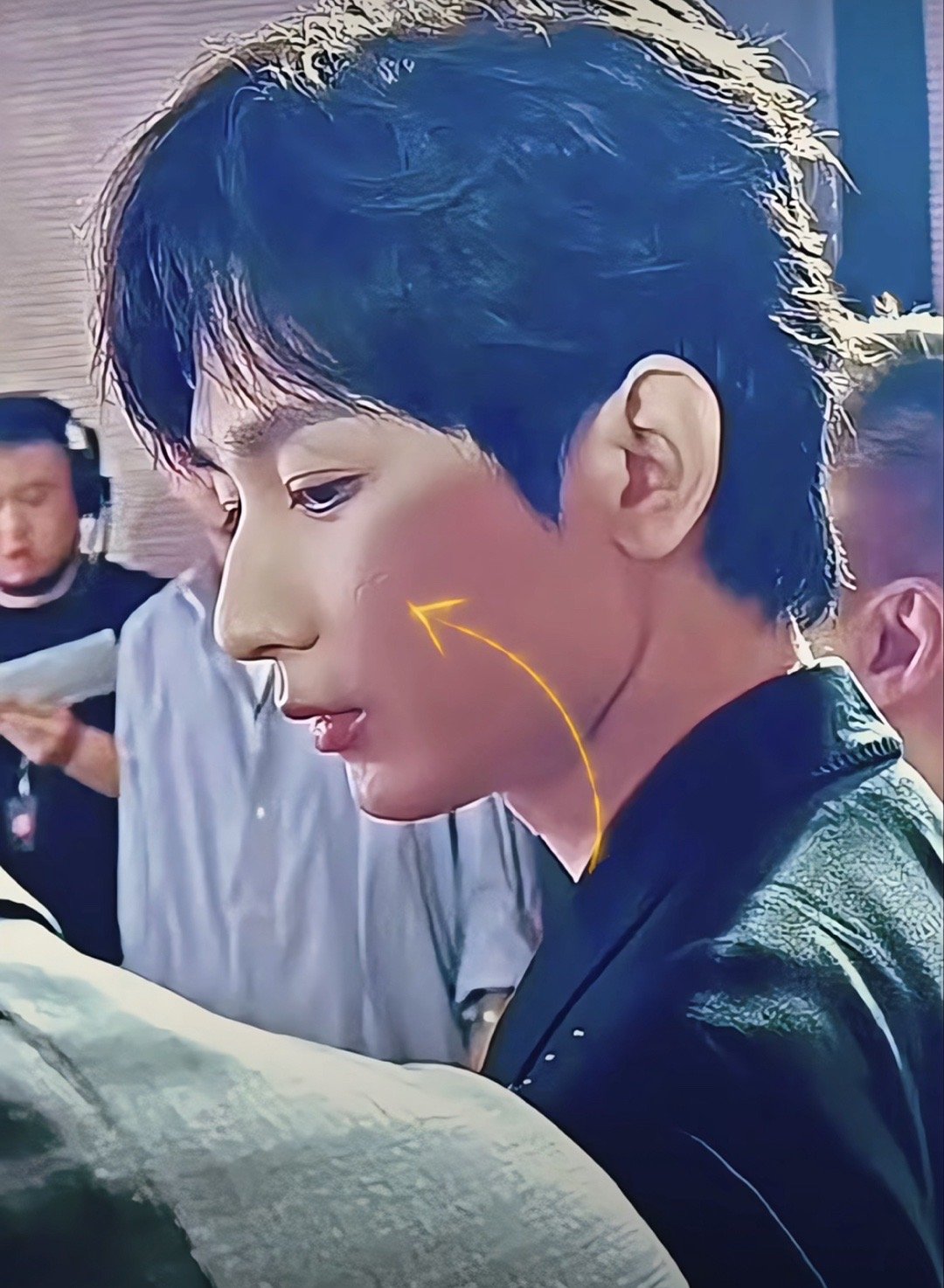成毅拍莲花楼时脸上留下的疤痕都这么久了还没好呢？ ​​​