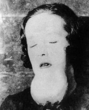 1922年5月，美国一20岁女孩因为牙疼剧烈难耐去看牙医，可让人万万没想到的事情