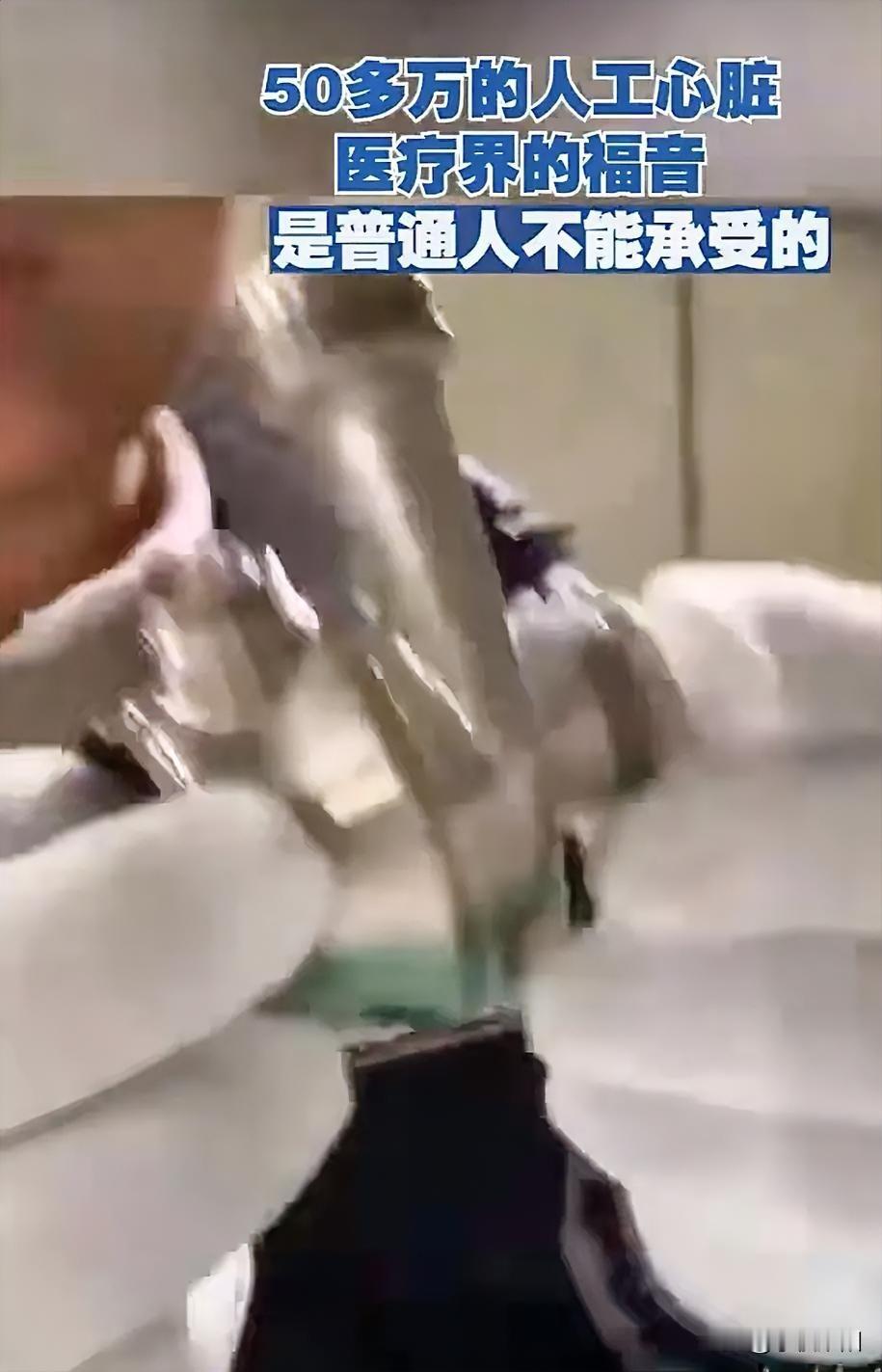 这人手里拿的这么个外观跟蜗牛一样的金属物件就是价值五十万的人工心脏，说实话还是第