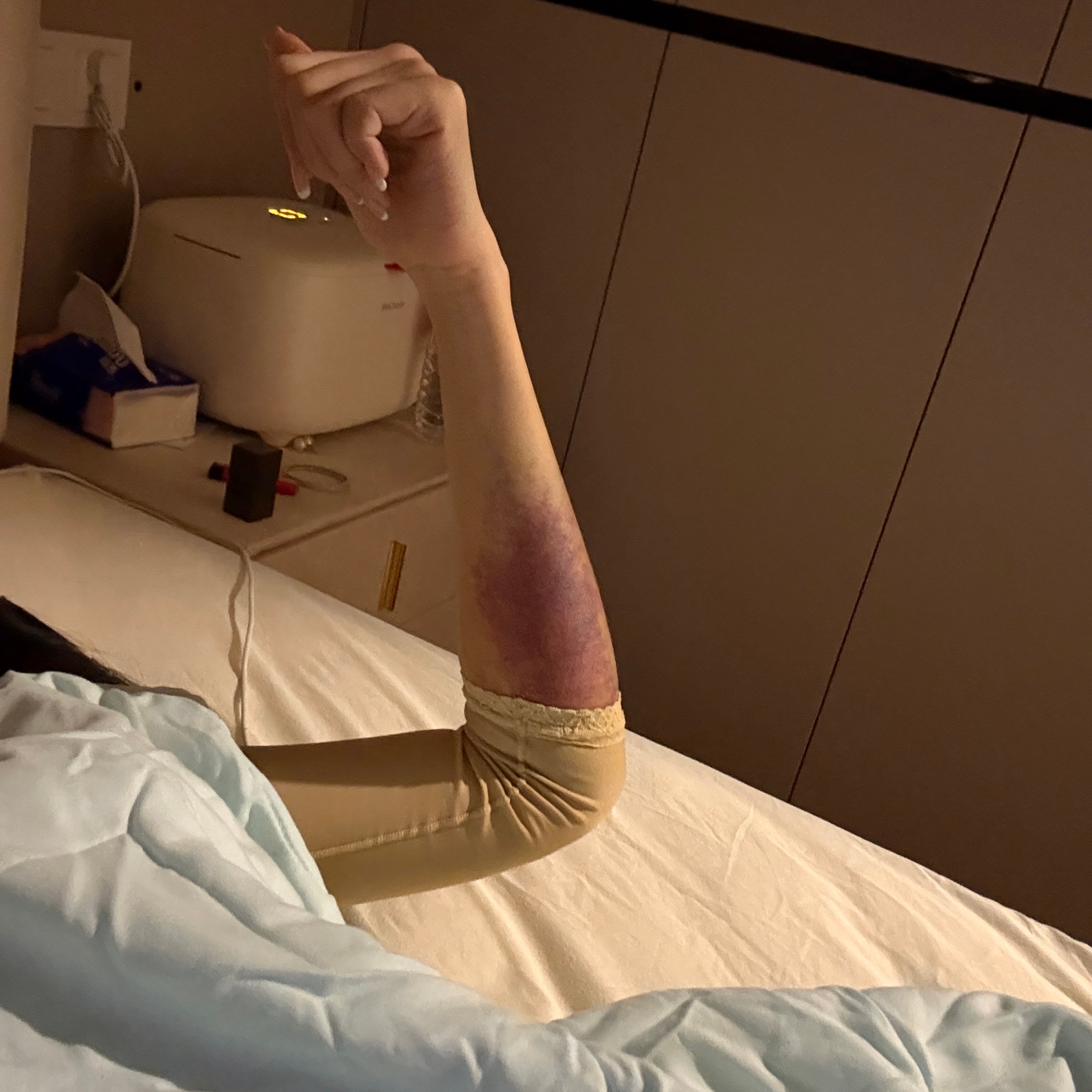 恢复期最痛苦的事情不是动不了（想吃的吃不了 怎么这么馋啊我 ​​​