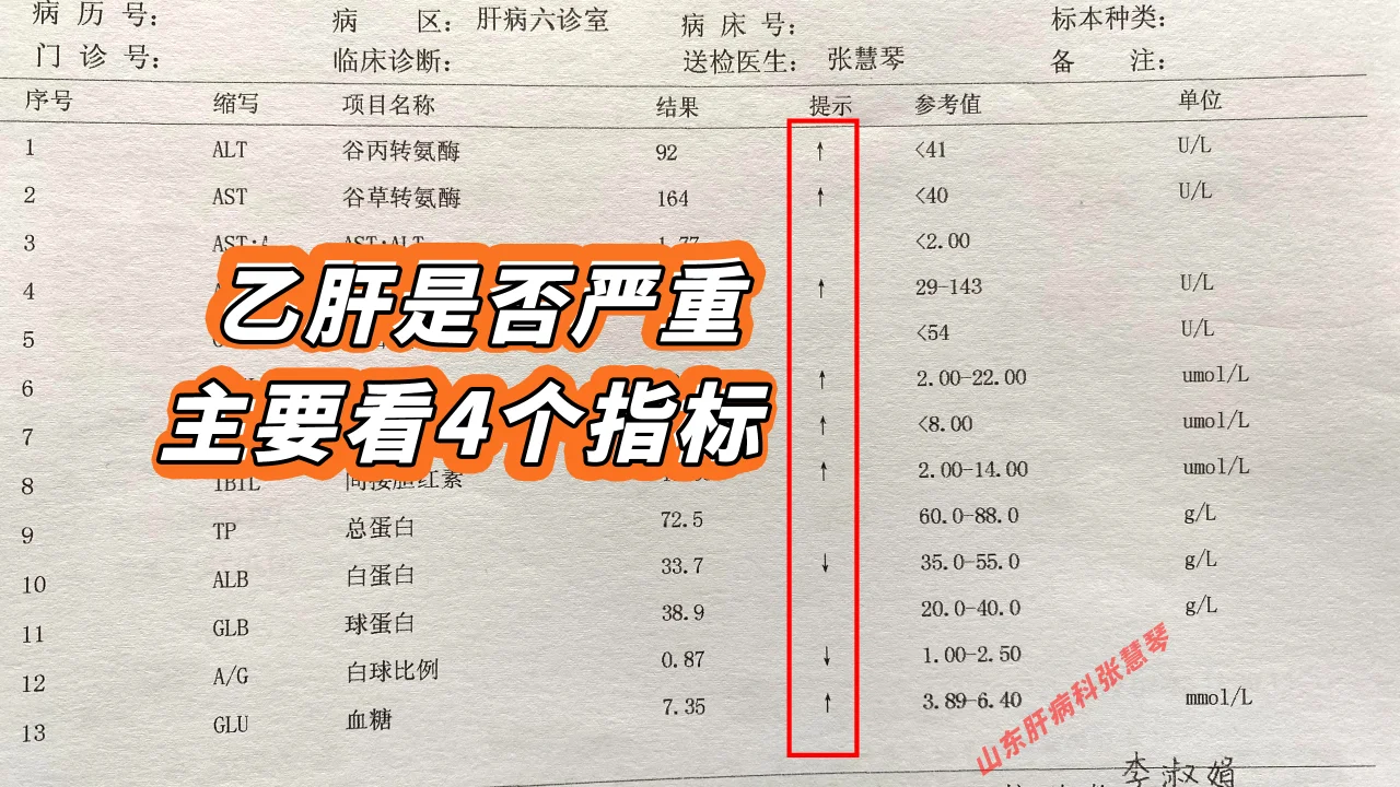 乙肝严不严重，主要看这4个指标，别耽误了