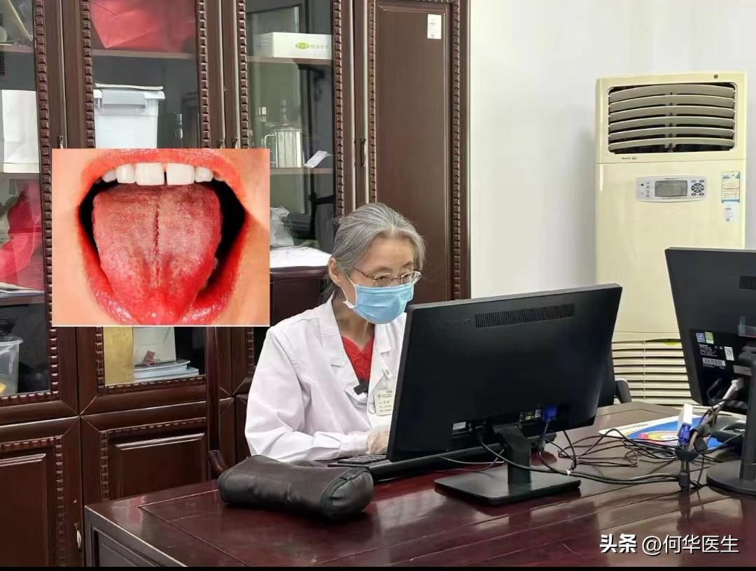 舌头裂纹那么深，还当脾虚湿气重调，小心竹篮打水一场空！

我们来看这个舌象

首