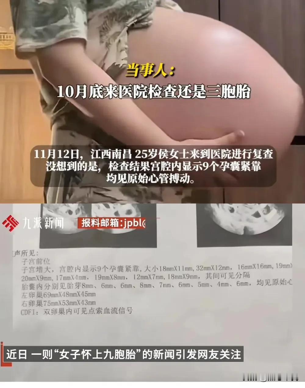 怀9胞胎女子18日做减胎手术：将分两次进行，减去七个胚胎

网友有话说：
1、别