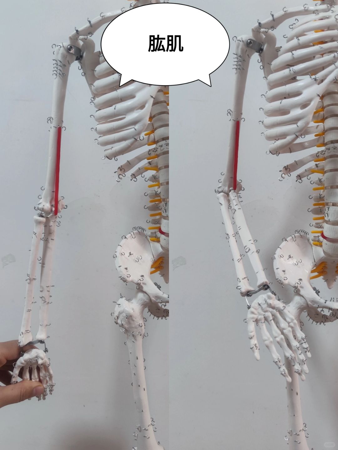 肱肌