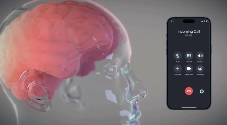 马斯克的脑机接口都有啥功能？装上一个芯片之后。

马斯克Neuralink的N1