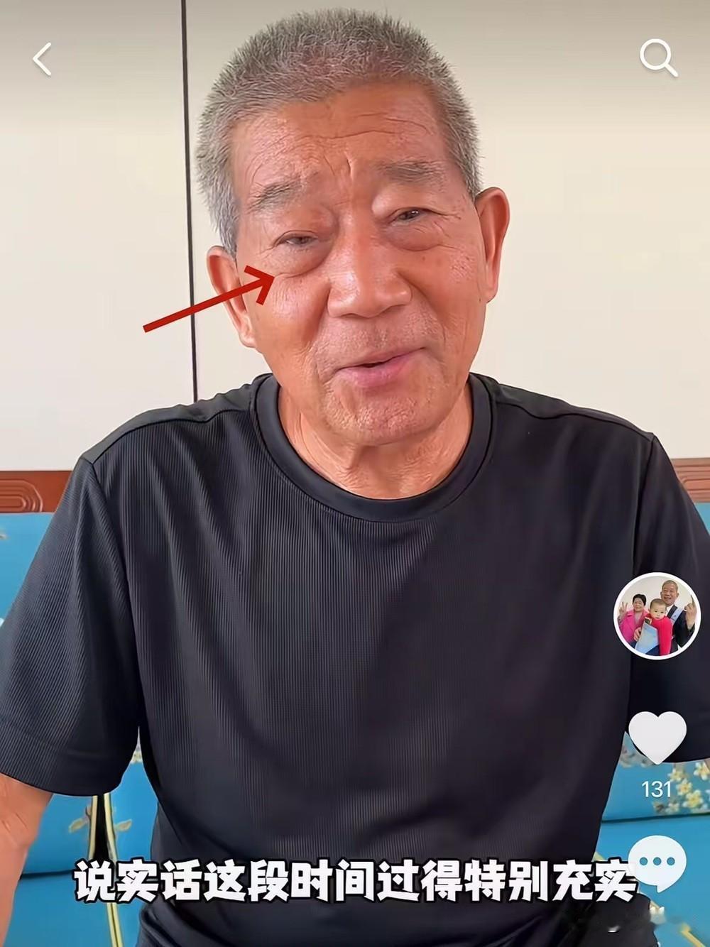 医院的长廊里，小天赐端水递药学着照顾妈妈。
妈妈60岁，她5岁。
这画面看多了，