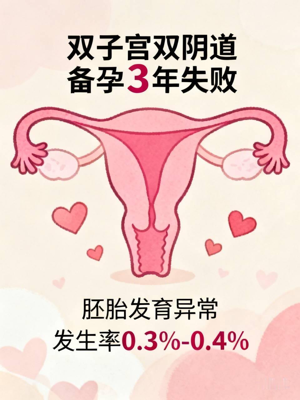 26岁女子双子宫双阴道备孕3年失败，这事儿听起来就让人心酸。双子宫双阴道是胚胎发
