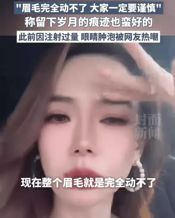 戚薇大方承认医美过度：打僵了，整个眉毛完全动不了