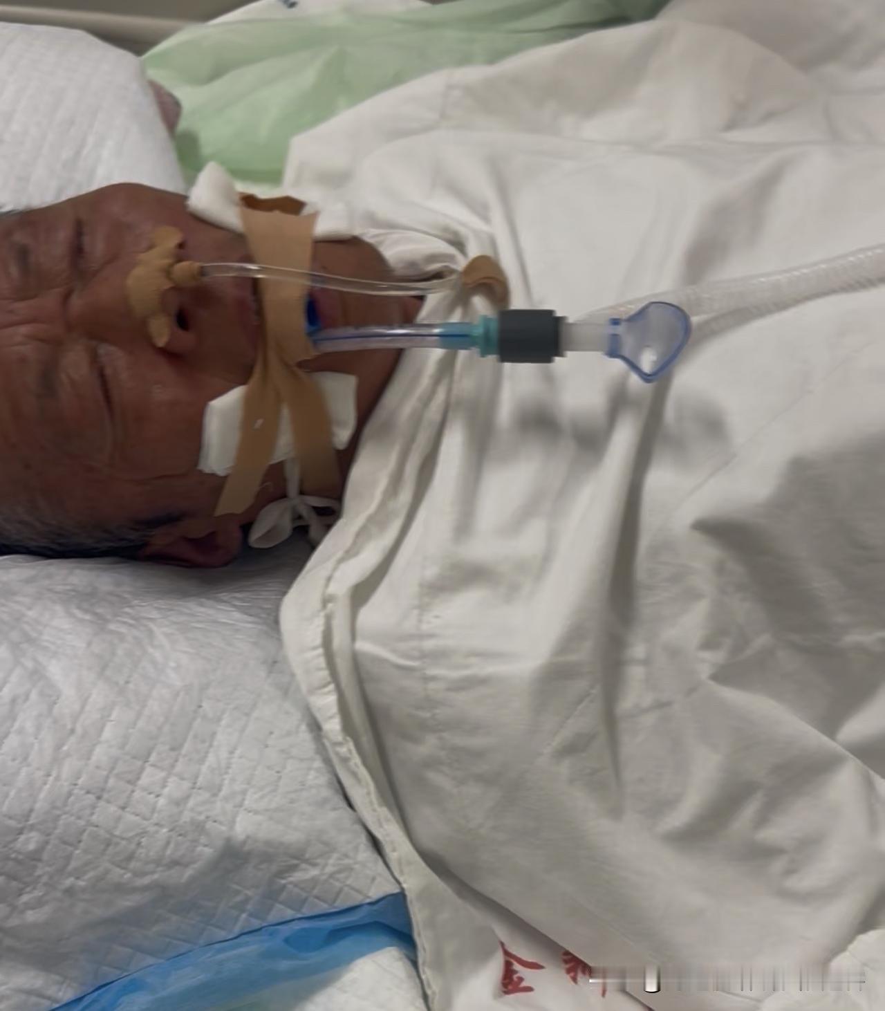 一、照护层面：家人精力被大量消耗

1. 日常起居负担加重
轻症者可能肢体麻木、