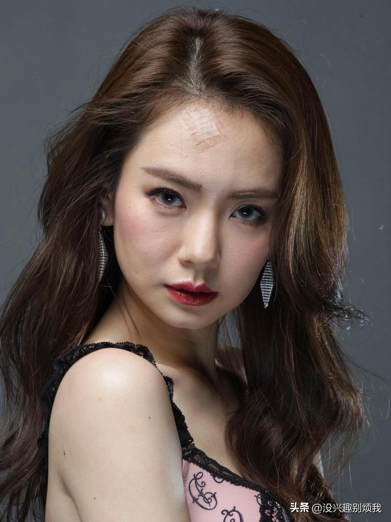 戚薇，她这额头是咋的了？