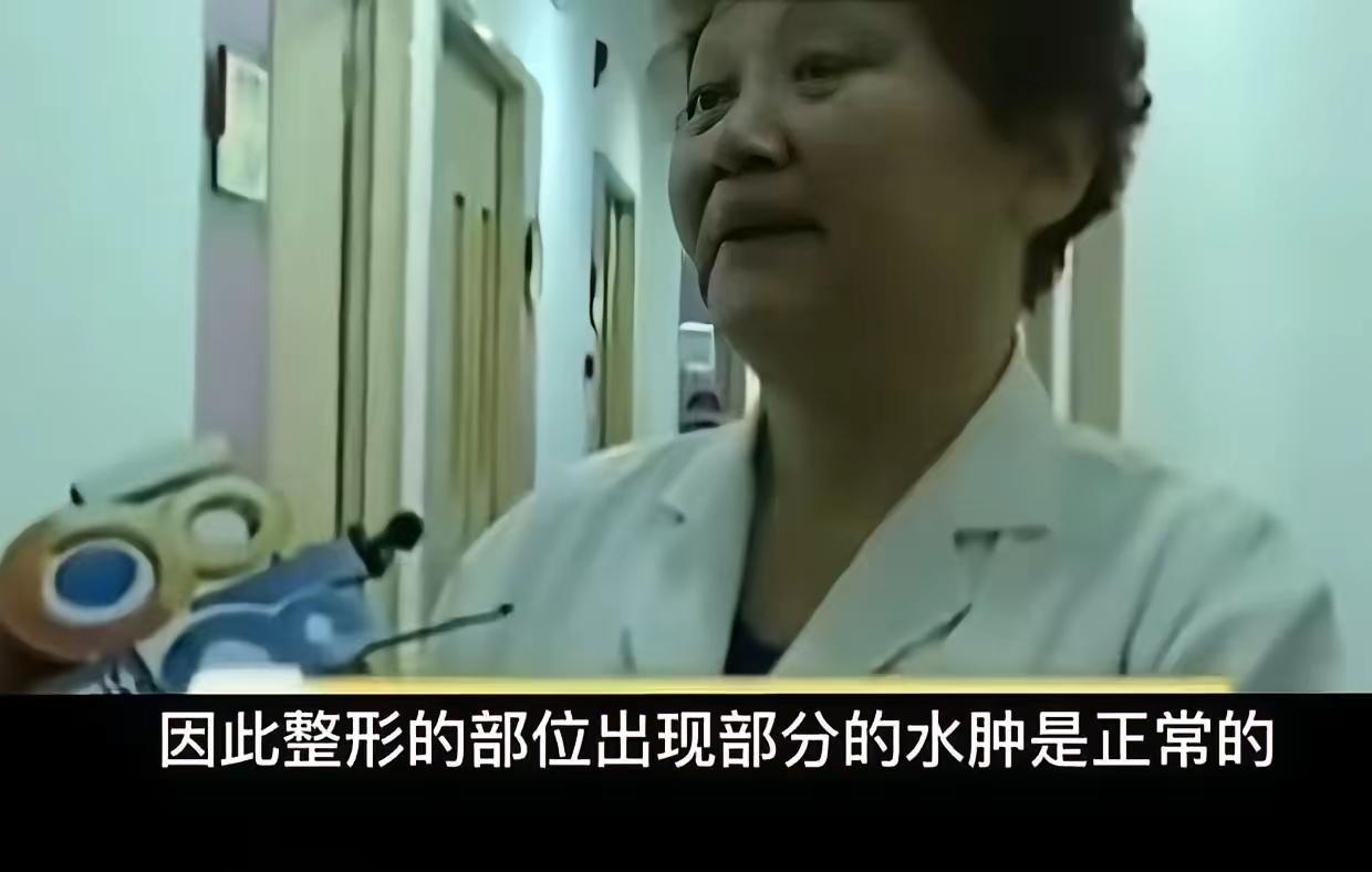 这个故事反映了许多关于自我认知、外貌焦虑以及整形风险的深刻议题。以下是一些观点和