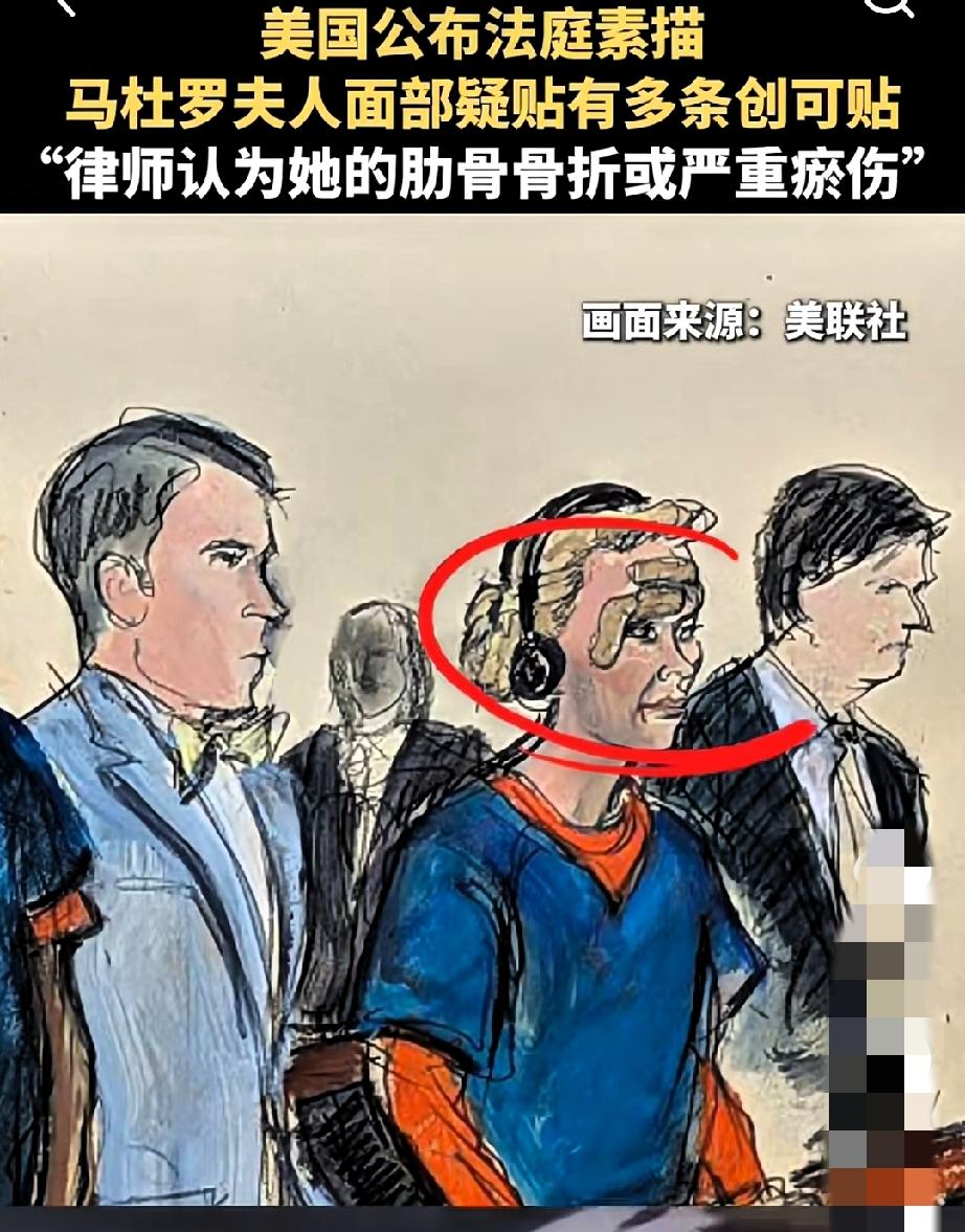 还真对她动手了？
真是坏事做尽，杀人放火啥都干。
就说对委内瑞拉总统夫人，竟下狠