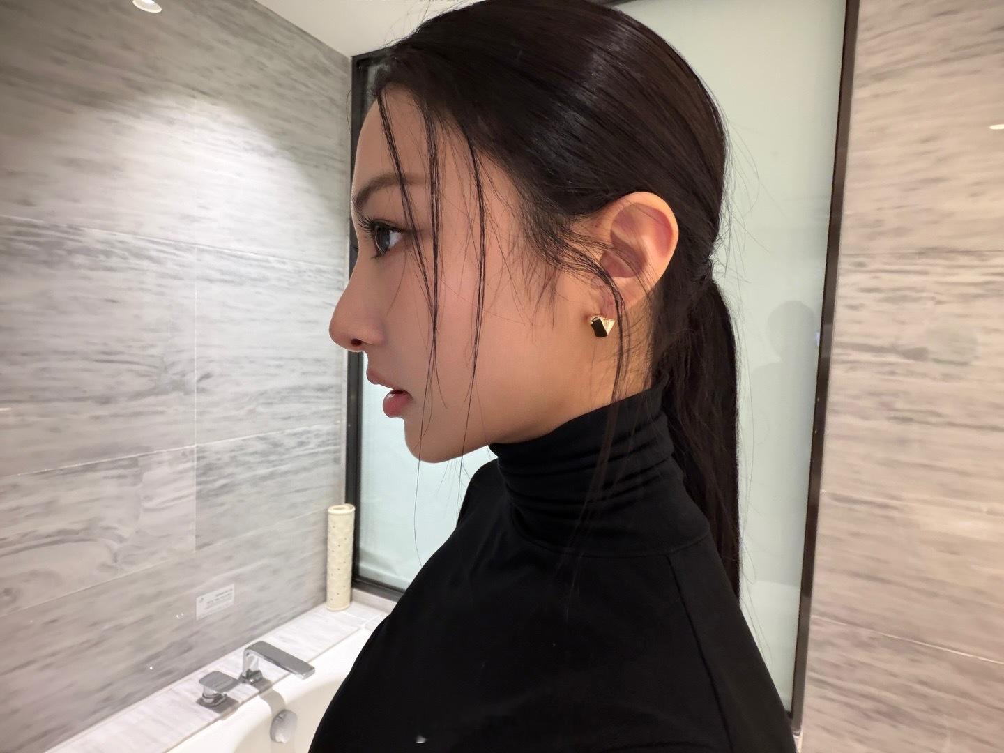 GAWON更新一组plog 