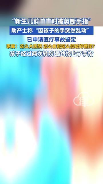 抱着刚满岁的娃刷到这新闻，我手瞬间攥紧了他的小拳头，

新生儿剪脐带居然被剪