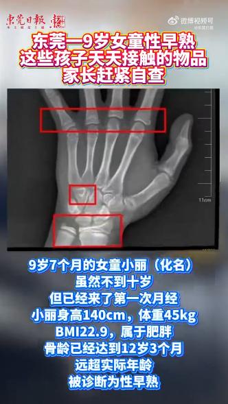 广东东莞，一9岁女童因月经初潮被妈妈带到医院，检查结果令人揪心：身高140cm、