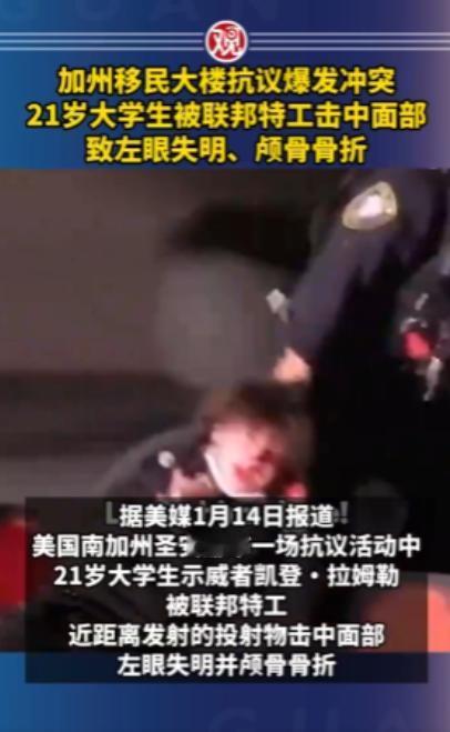 美国加州爆发抗议示威，一名21岁的大学生被特工一枪托爆头，眉骨断裂，眼睛失明。但
