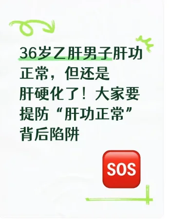 肝功能正常也可能肝硬化，警惕背后陷阱！