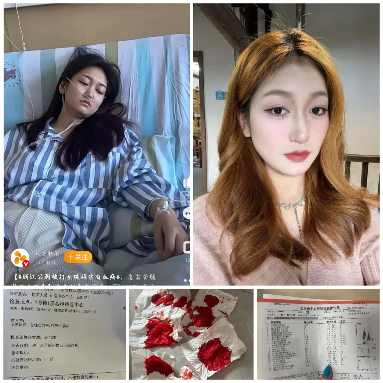 她只想活过20岁。
19岁躲场雨，
怎么就把人生逼到了生死边缘？

     浙