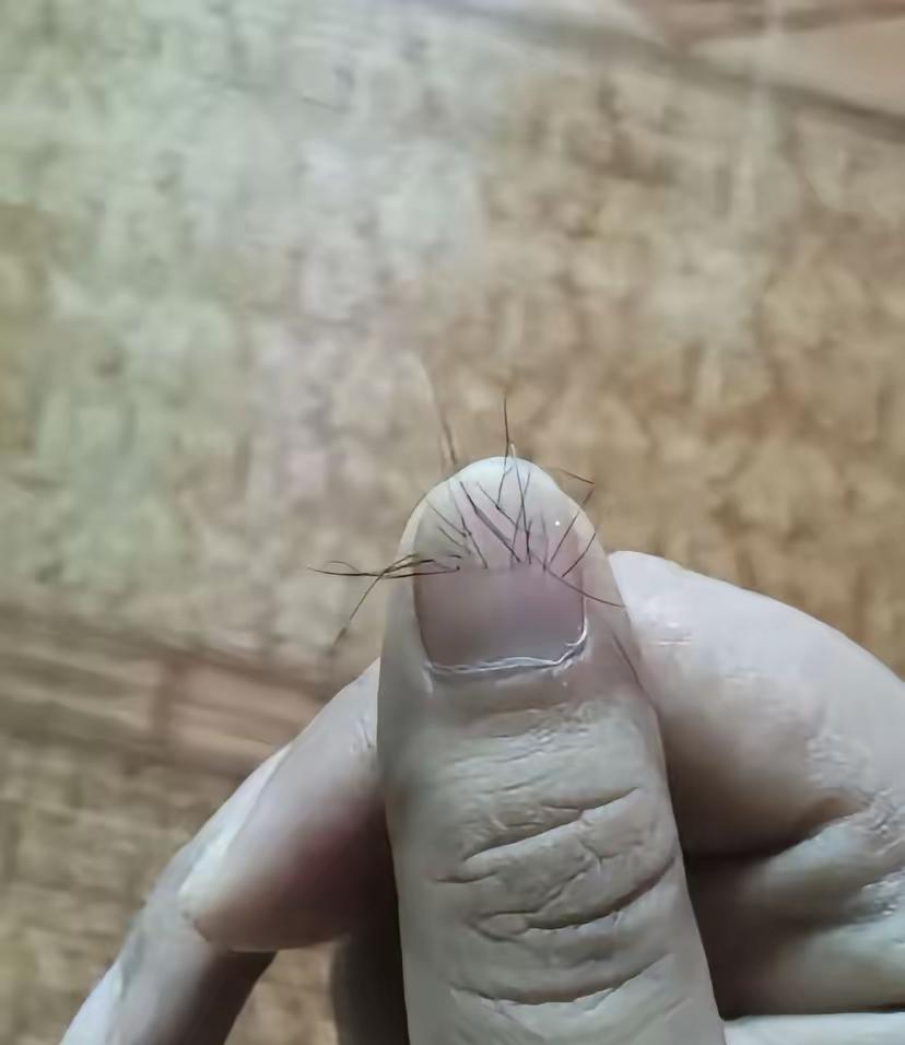 大千世界无奇不有，指甲上长毛，有点邪乎，这不是ai的吗？
如果是真的，必将突破医