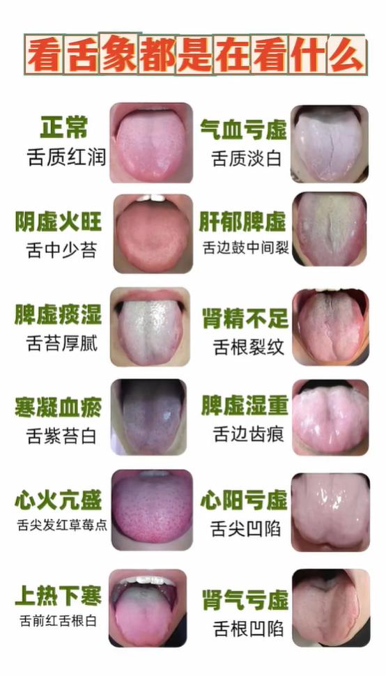 舌苔厚、舌有裂纹齿痕？对照舌象看懂自身问题