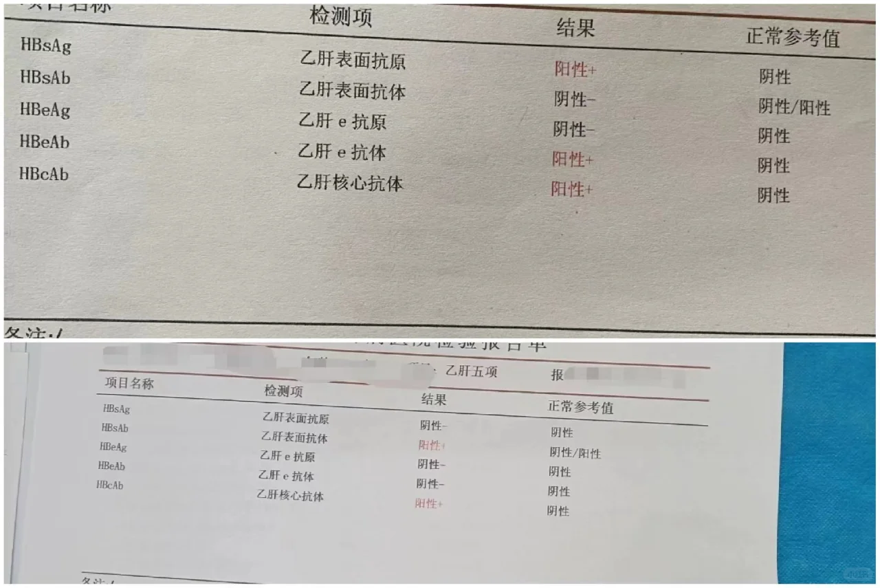 又一位乙肝患者成功摘掉了乙肝的帽子！