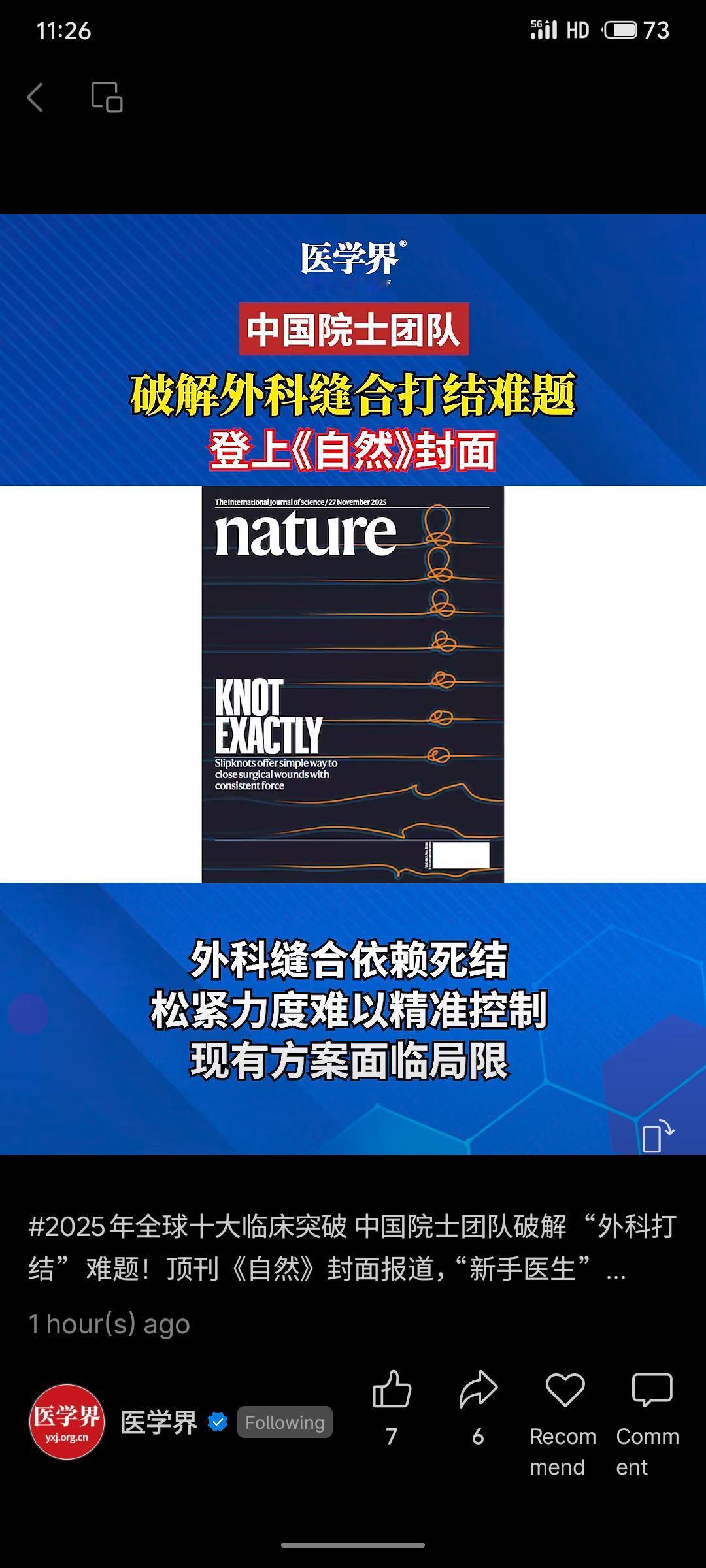 中国工程院院士团队研发出“活结智能缝线”，巧妙利用力学结构替代复杂传感器，成功破