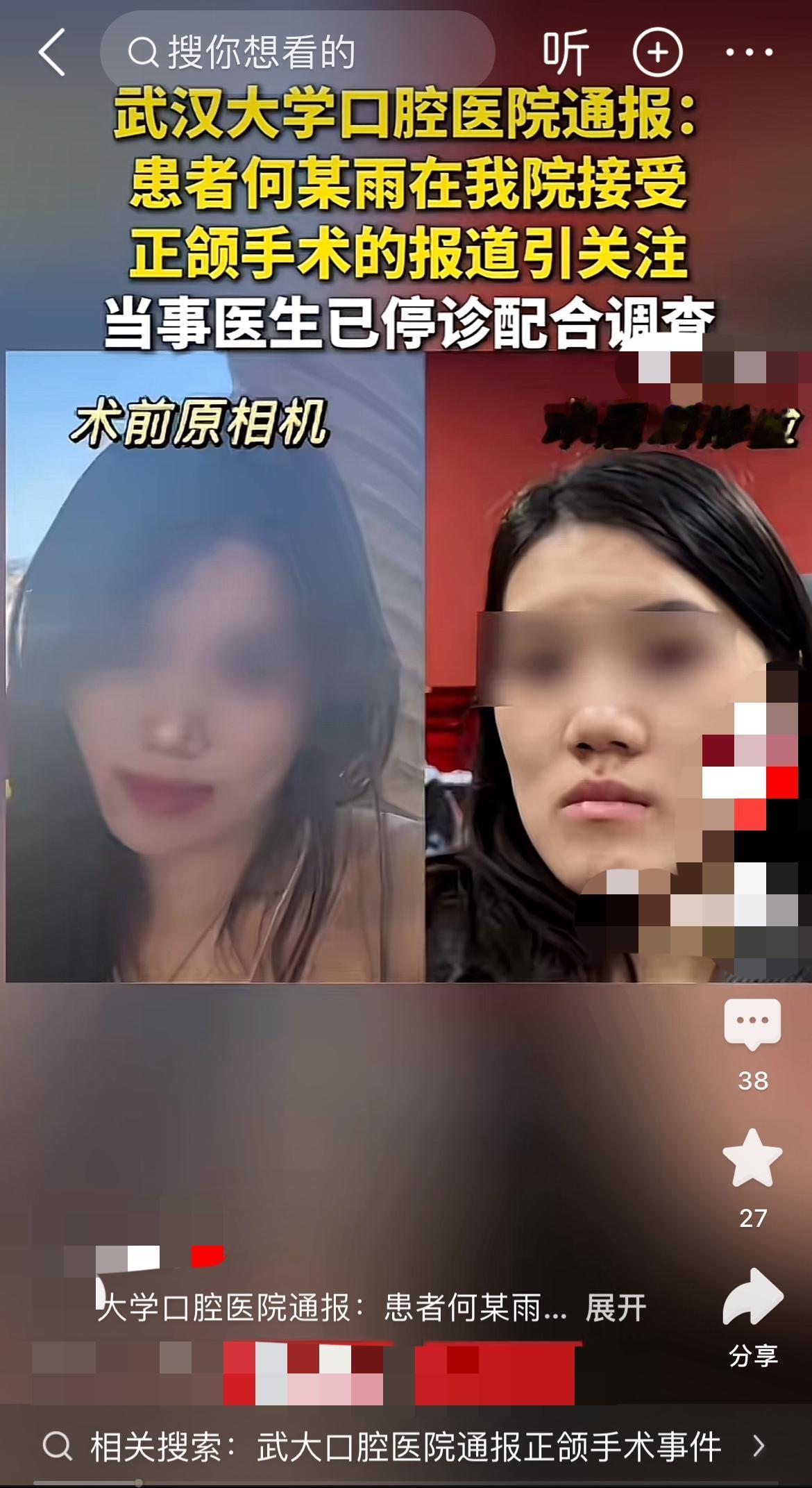 2毫米地包天被做反13毫米？正颌手术竟成毁容灾难？
“我喜欢你这个面型，现在比之