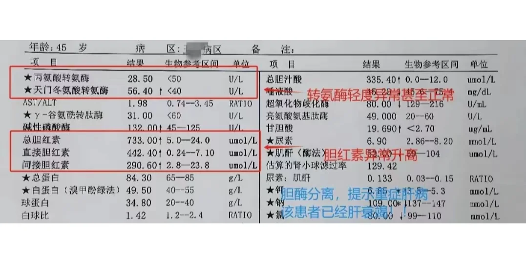 肝功能怎么看？