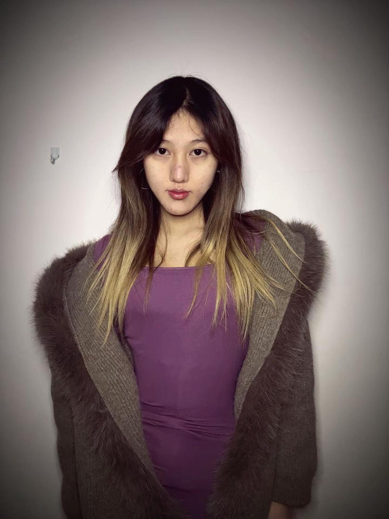 我恨死满脸的痘痘痘印痘坑了吴京 痘肌