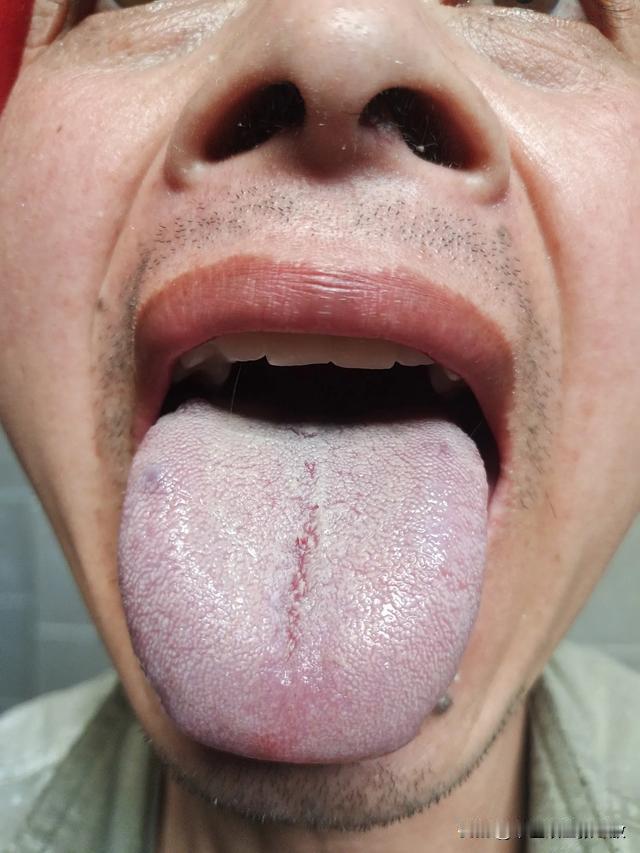 这大哥是被他媳妇拉来门诊的[捂脸]说整天在家懒得跟啥一样[狗头][狗头][狗头]