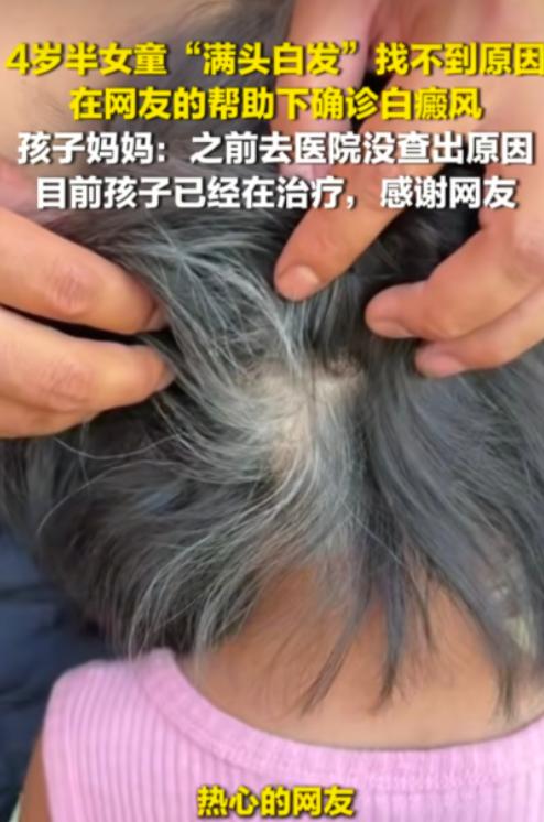 网友的含金量还在上升！

近日，贵州一位宝妈发帖求助，自己4岁女儿出现了大量白发