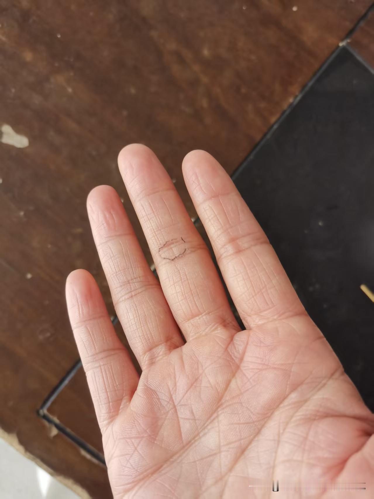 我闲着无聊，拿根一次性筷子去松铁树花盆里的土。
后来觉得右手中指扎扎着疼，我迎着