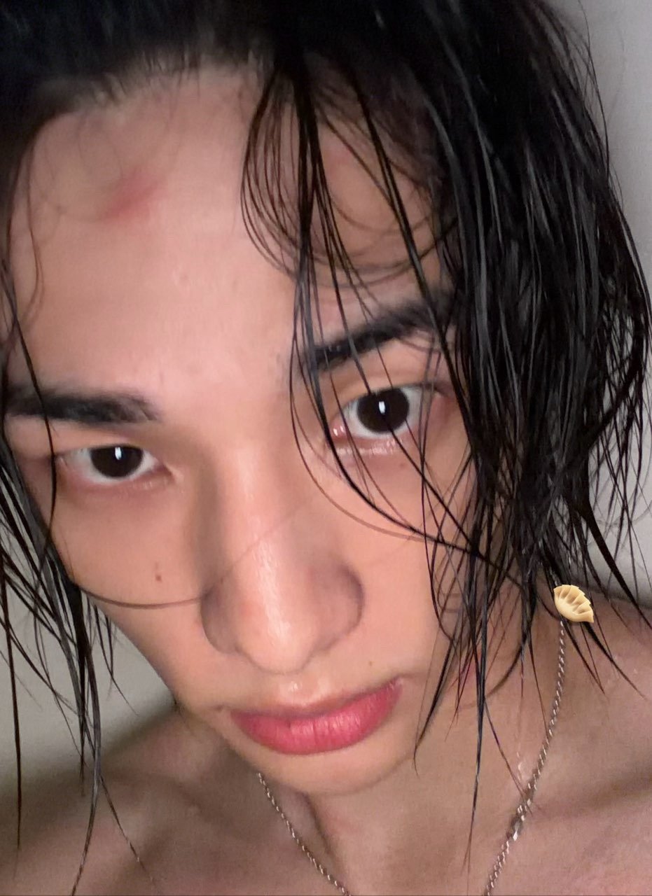 原来被蚊子咬有果照看 