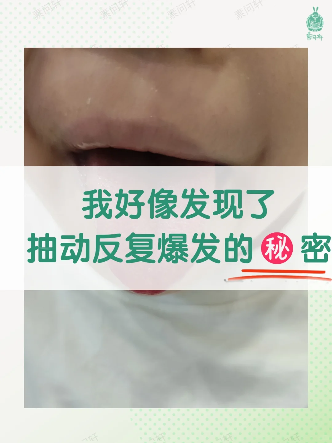 我好像又发现了抽动反复与爆发的㊙密