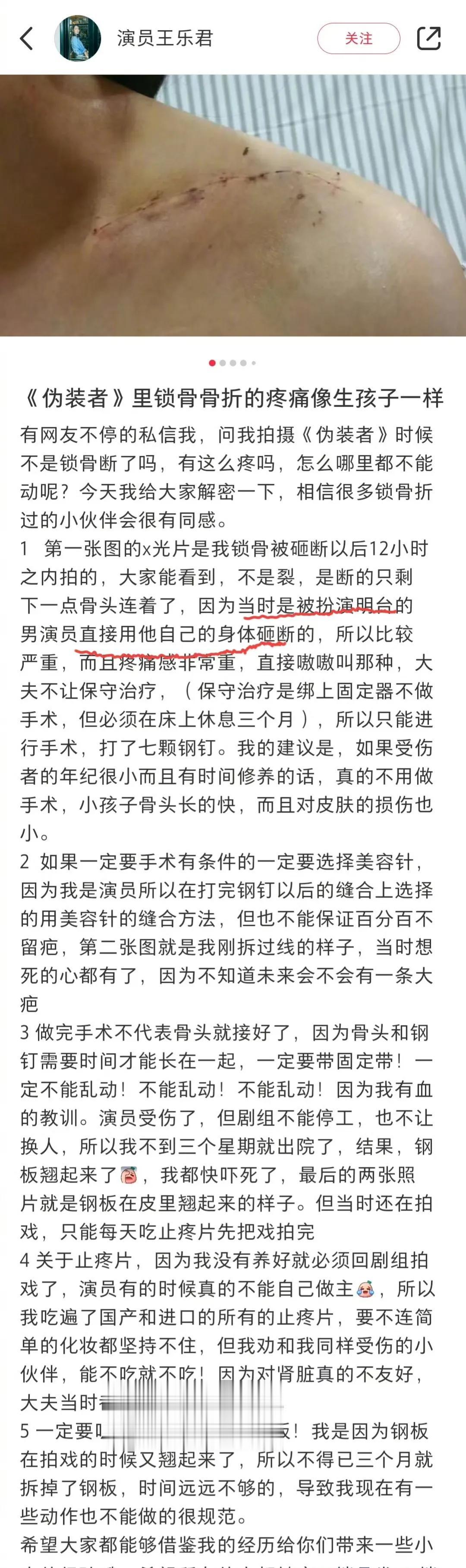 胡歌摊上大事了，演员王乐君控诉胡歌将她砸倒，暗讽胡歌人品，被网友扒出王乐君人品不