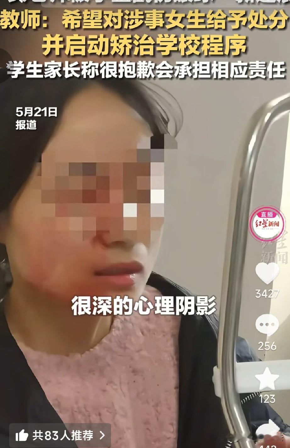 戳伤老师眼睛的那个女孩，当天是和一个男生打架。老师说这个女孩经常和别人打架，她当