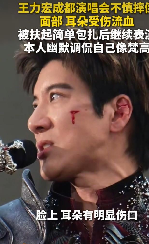 王力宏演唱会意外摔伤，脸耳合计缝39针
 
7月4日，王力宏成都演唱会突发舞台意