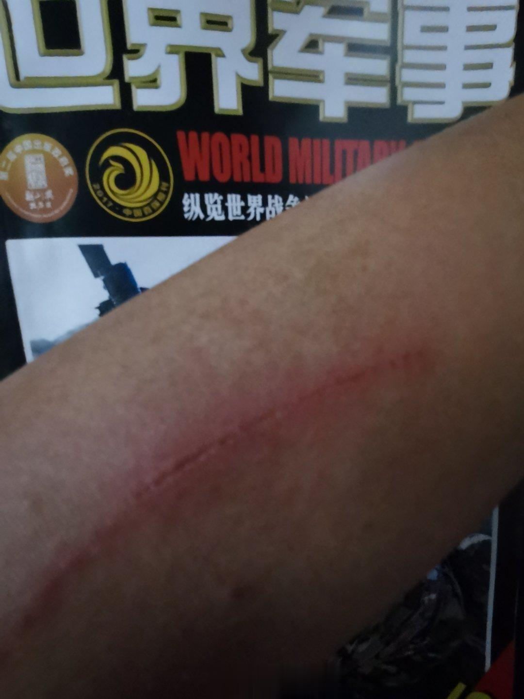 疤痕见证成长[喵喵] ​​​