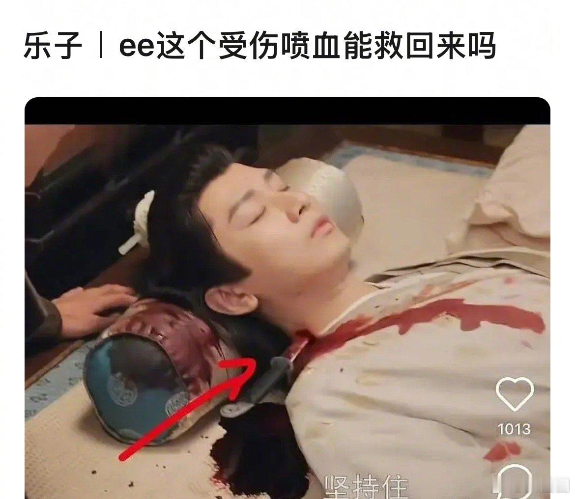 成毅长安二十四计中扮演的角色受伤引起医学讨论～