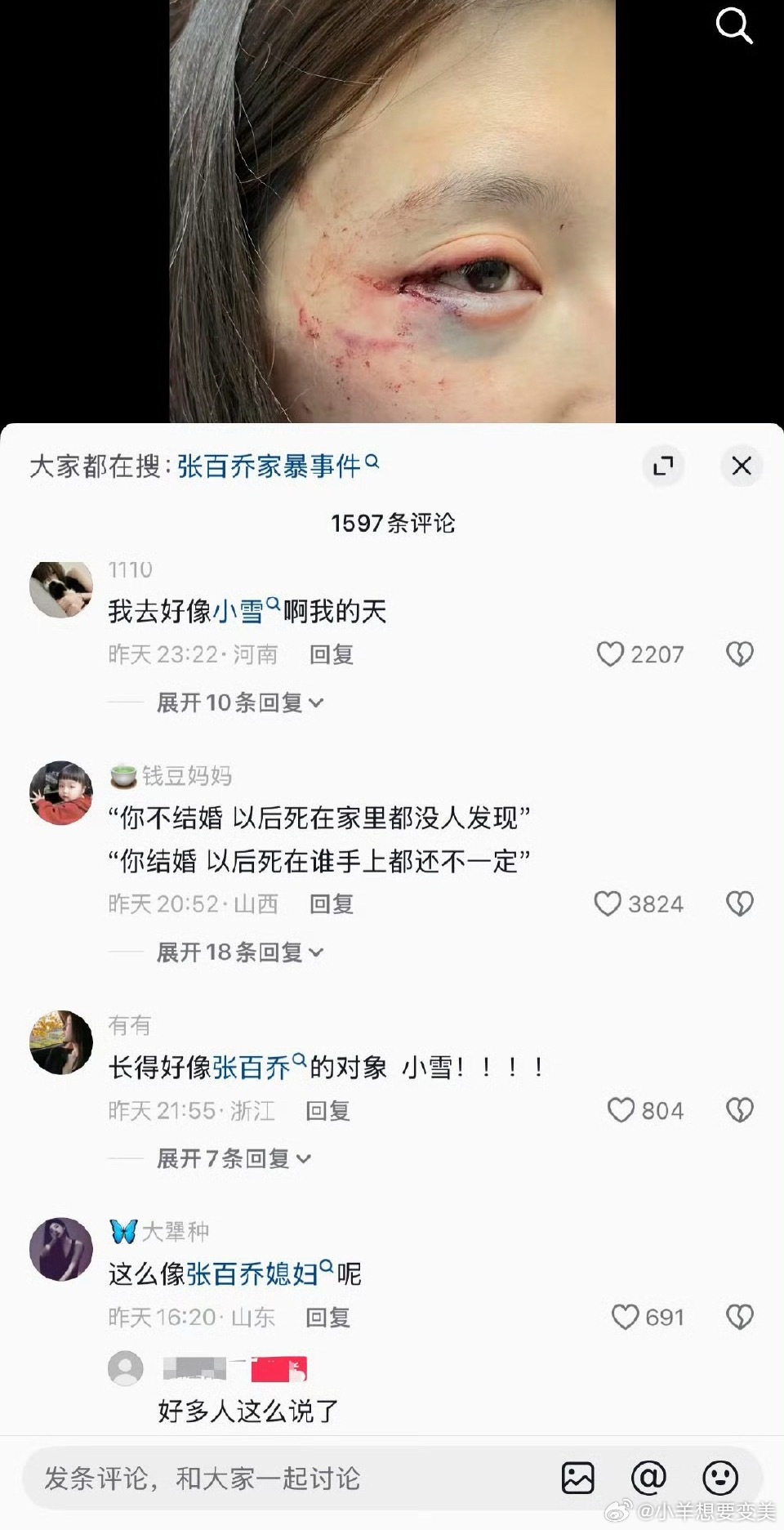 张百乔老婆回应被家暴张百乔夫妇最近得罪谁了 怎么老被传八卦 