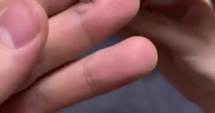 长春一男子在花生米中吃出假牙，当事人：想起来就恶心，看球赛的心情都毁了，想要个说法
