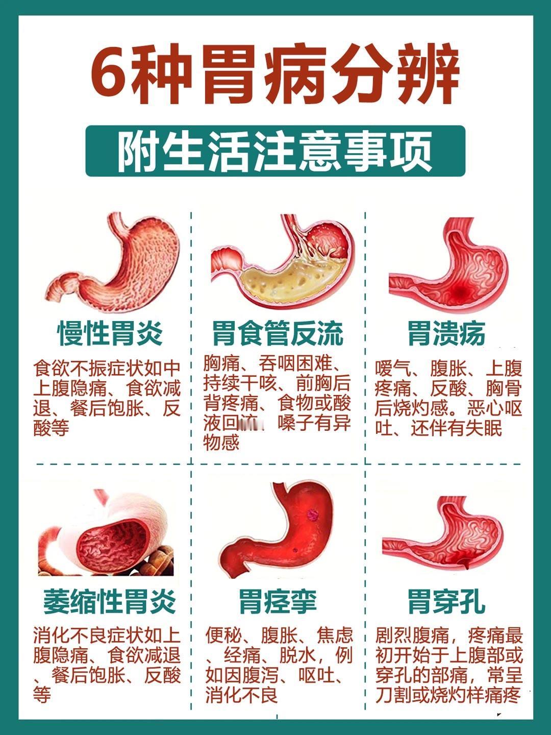 6种胃病分辨，摆脱胃病困扰！