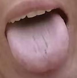 虚实夹杂体质调治：阴阳双补结合健脾化湿思路






不少粉丝倾诉：早年长期耗